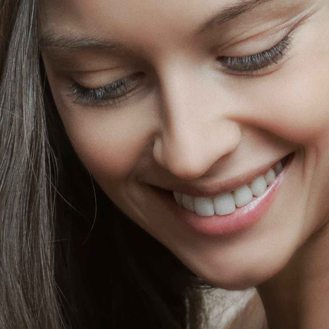 I Got Filler To Soften My Nasolabial Folds — Here’s My Before And After