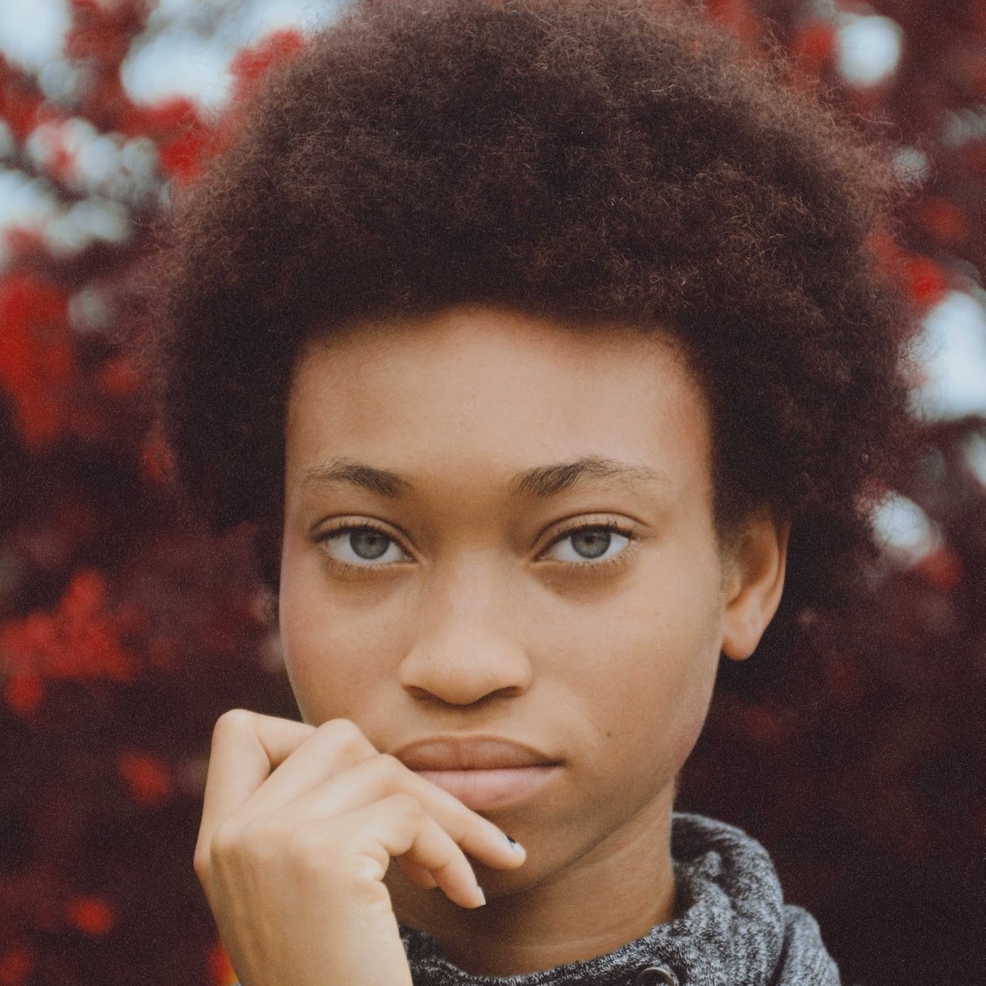 Are Your Dark Circles Actually Hyperpigmentation?