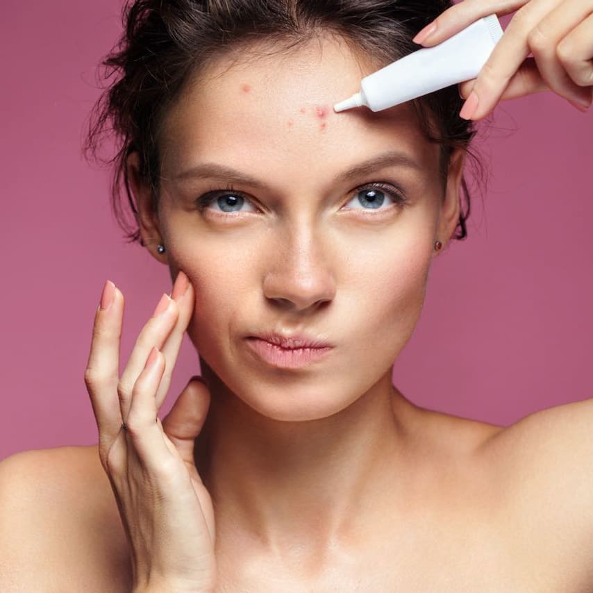 Read The Label: All Your Benzoyl Peroxide Questions Answered