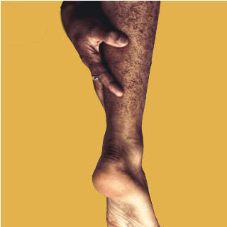 Calf Implant