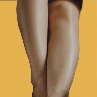 Calf Reduction by Selective Nerve Blocking