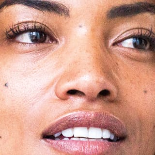 Lip Augmentation Solutions