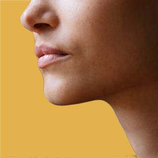 Closed Rhinoplasty