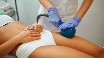 The Complete Guide to Cellulite