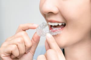 15 Things I Wish I Knew Before Getting Invisalign