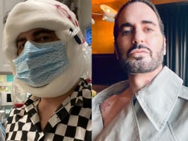 Why Marc Jacobs’ Transparency About His Facelift Matters
