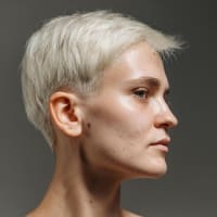 The AEDIT team covers PRP for Acne Scars: With or Without Microneedling?