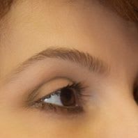Eye Rejuvenation Solutions After, undefined undefined - 3975