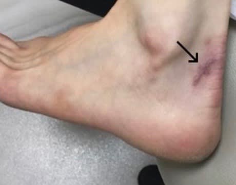 Scars Before, undefined undefined - 1709
