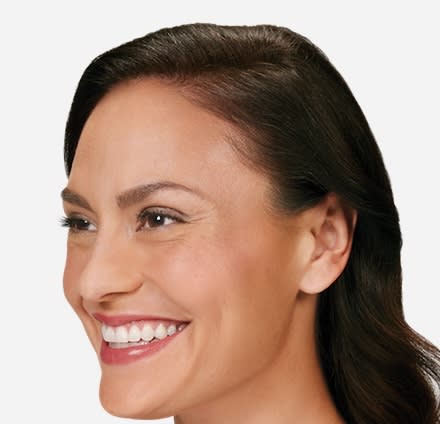 Botox Before, undefined undefined - 4856