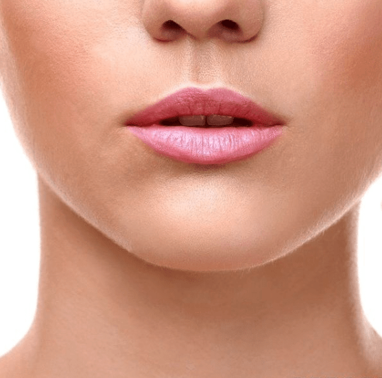 Lip Augmentation and Injections Before, undefined undefined - 1407