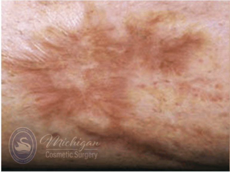 Scars Before, undefined undefined - 4270