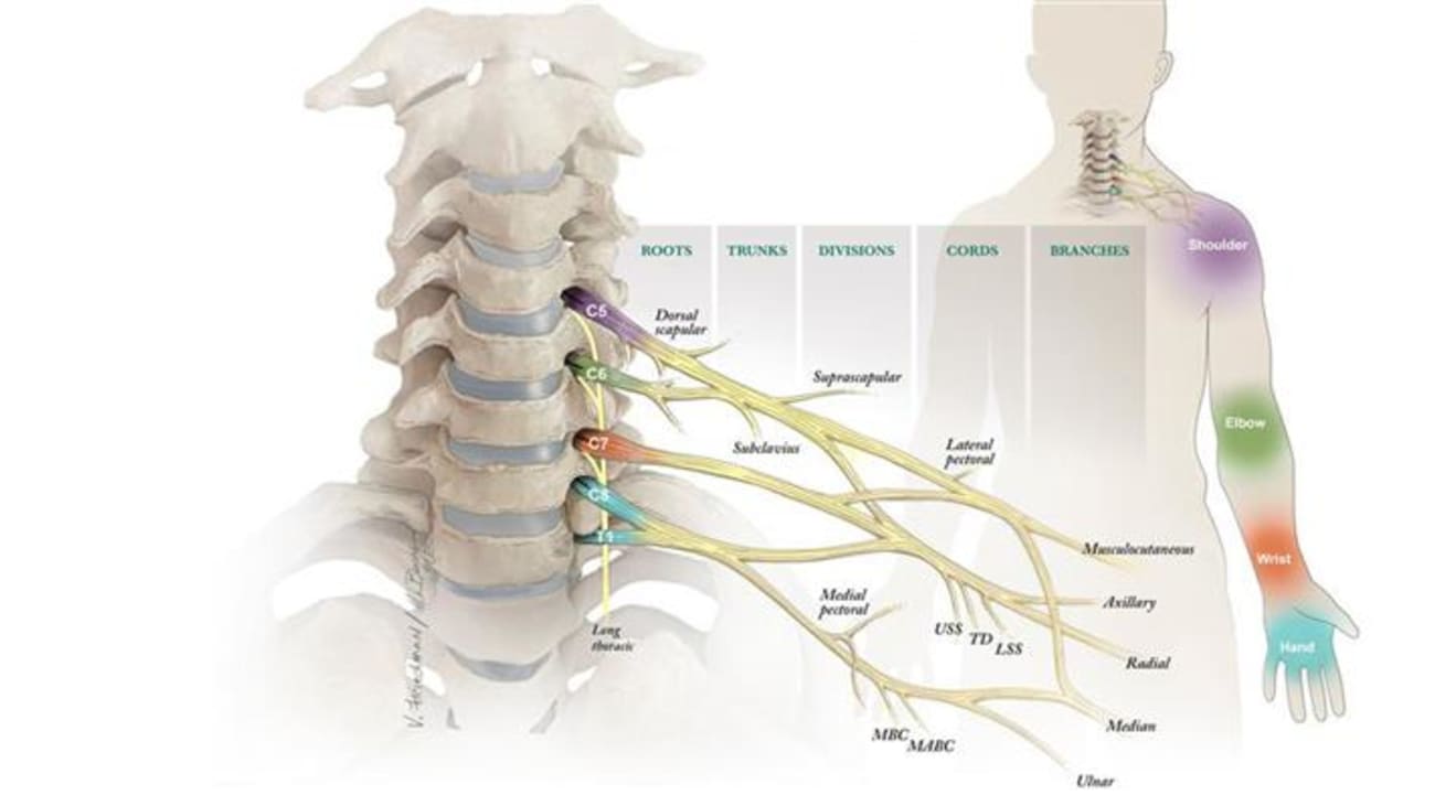 Brachial Plexus Injury