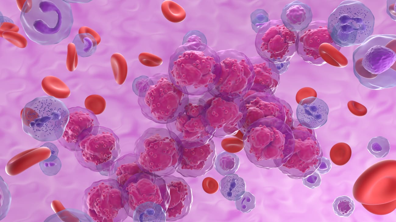 blood cancer
