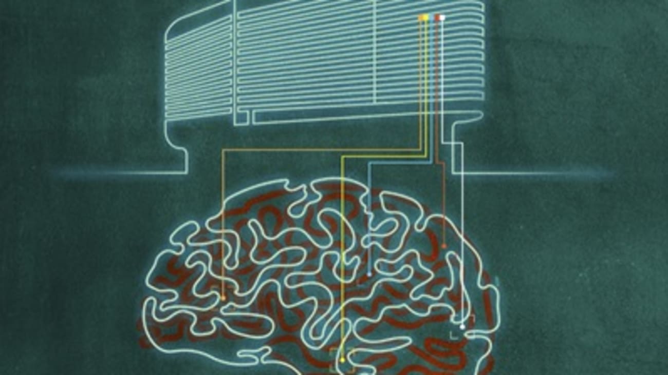 BrainIMG1