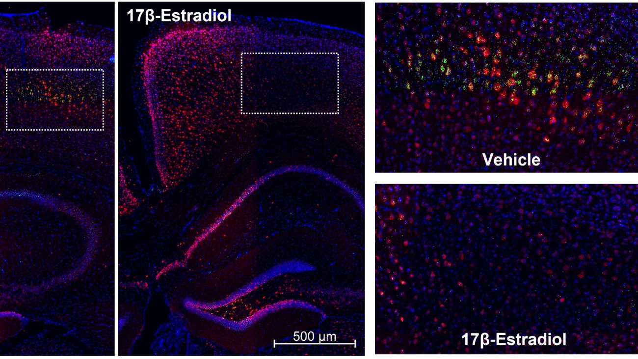 In these microscopic images of brains from mice with urinary tract infections, areas of injury are shown in green. There was less brain injury and fewer delirium-like behaviors in mice treated with estrogen (“17b-estradiol”) than in those treated with a placebo (“vehicle”).