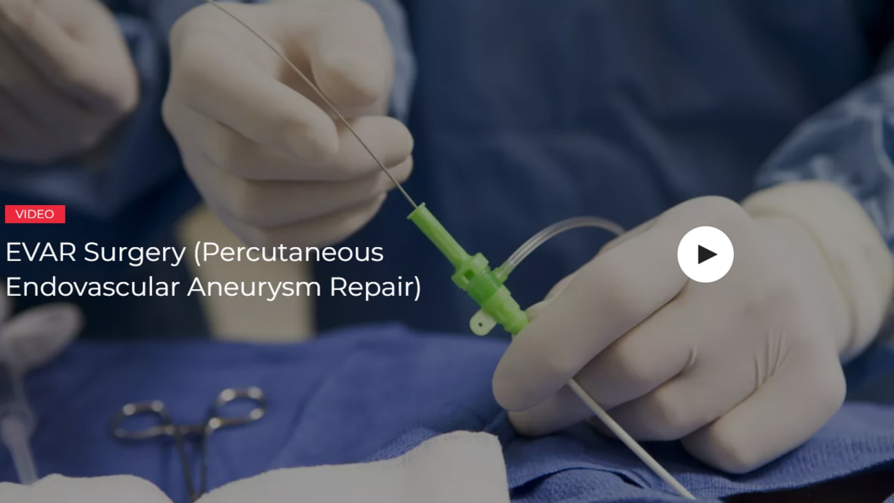 EVAR Surgery Aneurysm Repair Screenshot