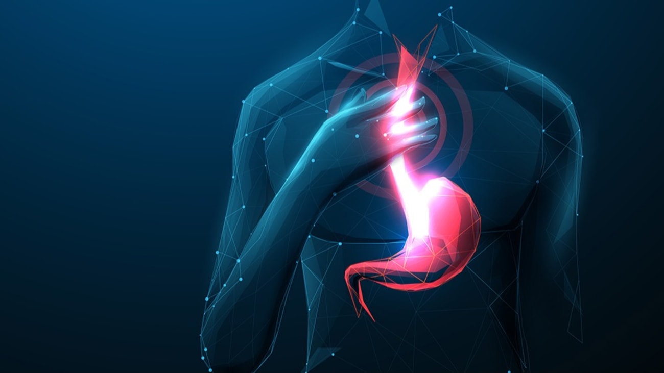 Hiatal Hernia and GERD copy.jpg