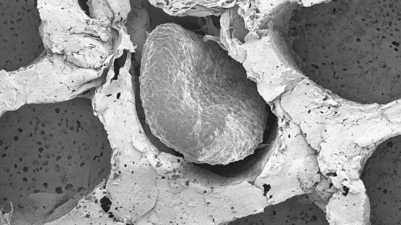fat cells Electron microscopy of fat organoids that were implanted to out-compete tumors. Image by Desai Lab