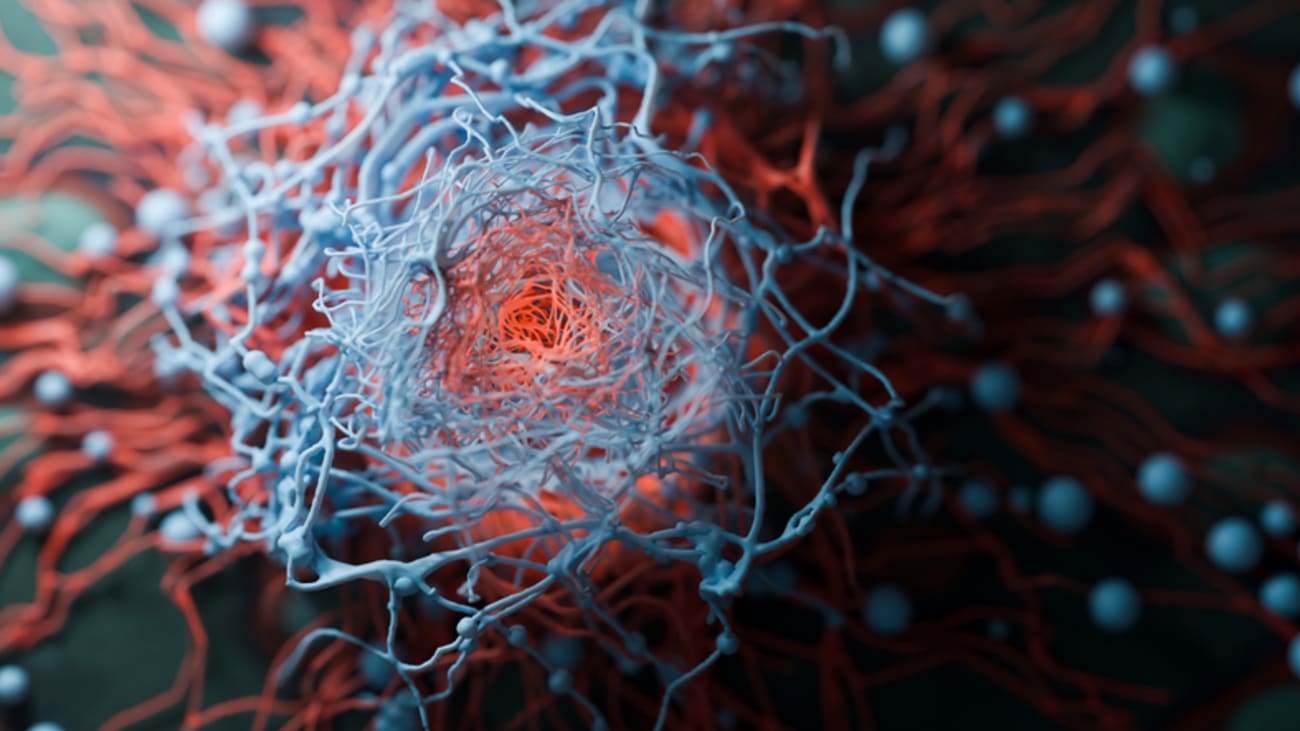 pancreatic cancer