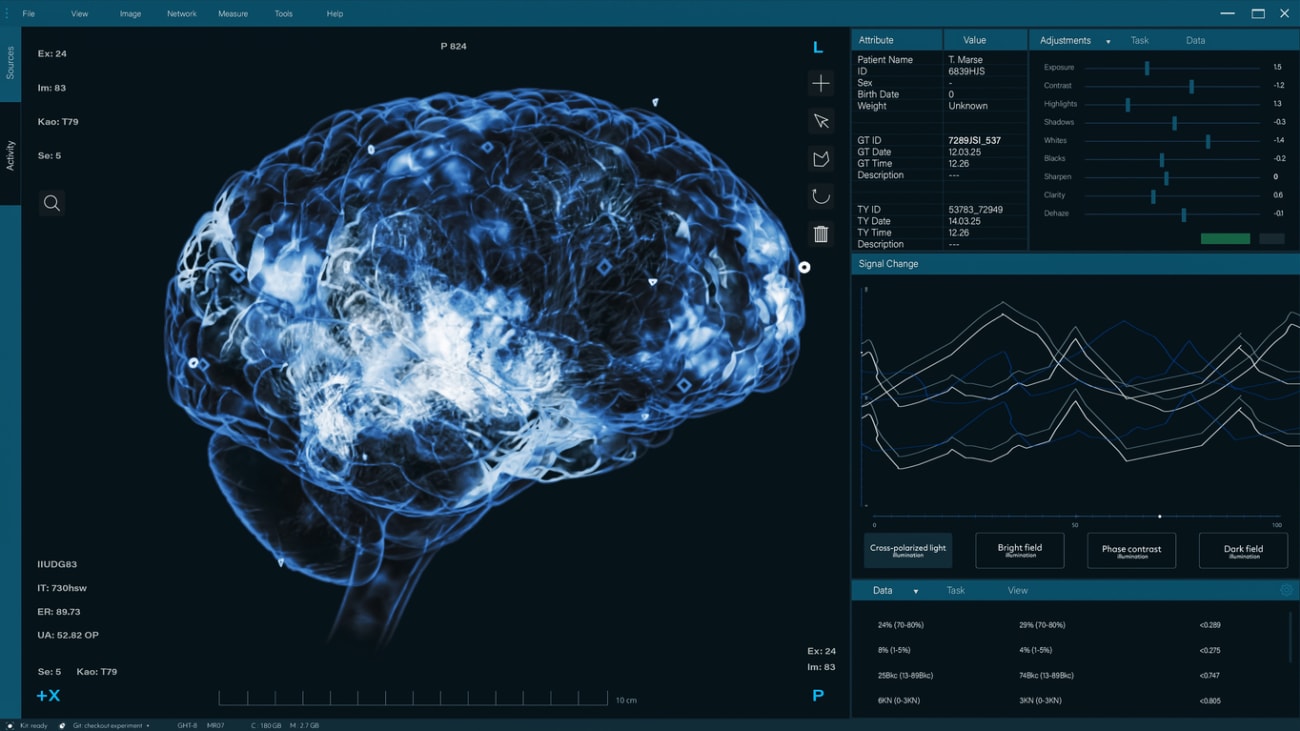 brain mapping