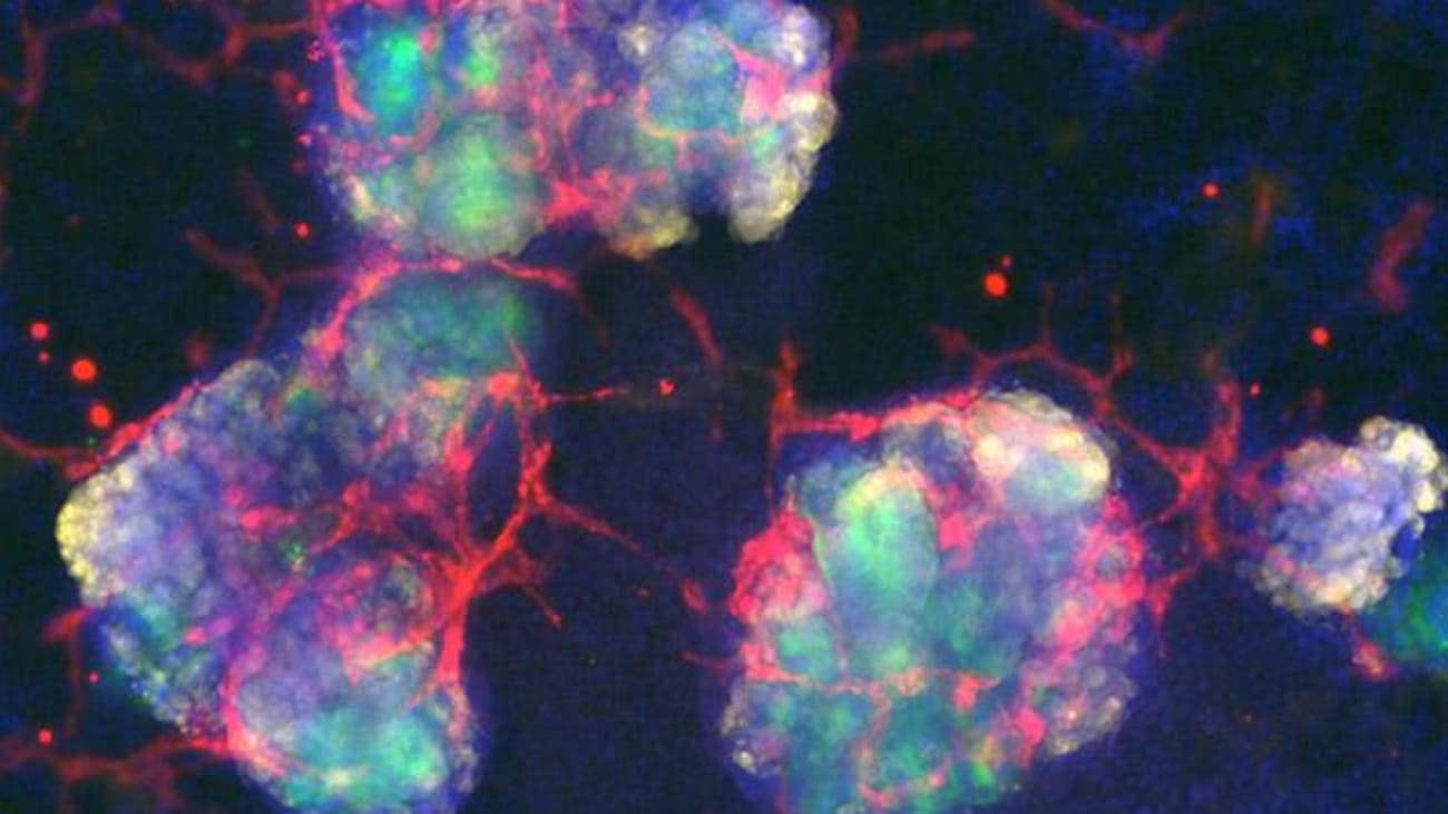 Human kidney organoids with associated blood vessel networks. Structures such as these will be used to study the effects of genome editing for human use.