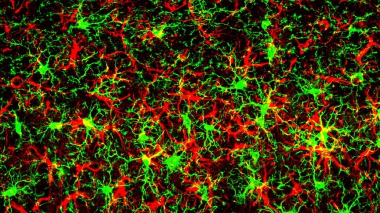 reactive-gliosis-fluorescent-image A fluorescent image displays reactive gliosis – a condition found in many neurodegenerative diseases – in the cerebral cortex induced by astrocyte-expressed GADD45G, the protein product of the Gadd45g gene. Reactive astrocytes are shown in red and reactive microglia are green, both common glial cell types.
