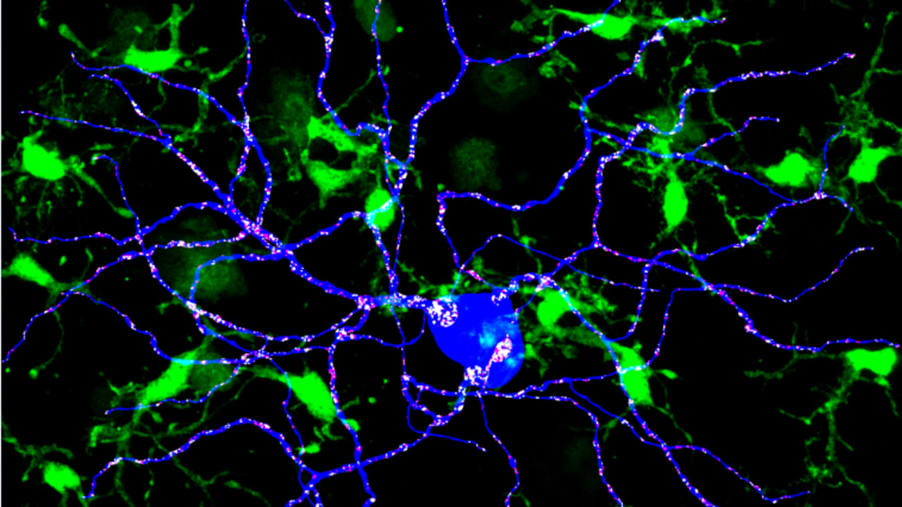 Small-Molecule Drugs Induce Sex-Specific Resilient Microglia Phenotype in Mouse Model