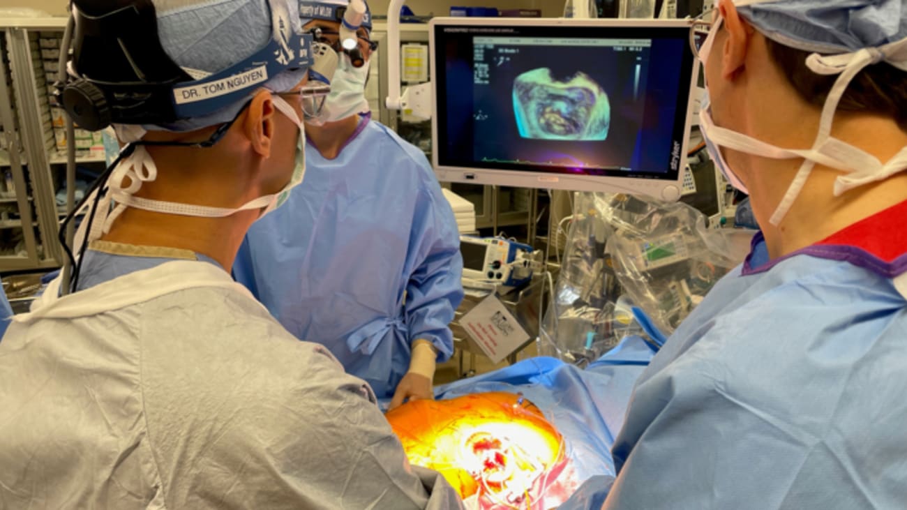 ucs_mitralvalveprocedure