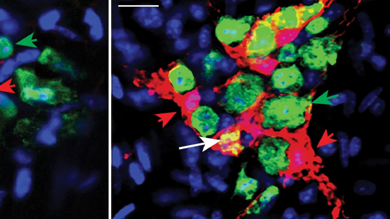 pasricha kulkarni PNAS image 2 In the first-ever images of the death and birth of intestinal nerve cells, the first photograph depicts the loss of adult mouse enteric nerve cells. The red shapes are dead neurons. Neurons that are stained with a green nuclear dye are marked for programmed cell death. The green shapes are new neurons emerging from their precursor cells, highlighted in red.