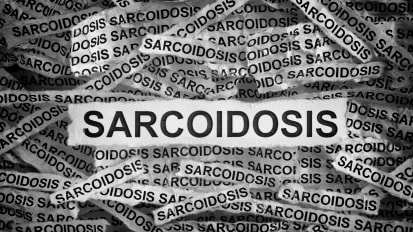 Sarcoidosis - A Contemporary Challenge in Clinical Practice