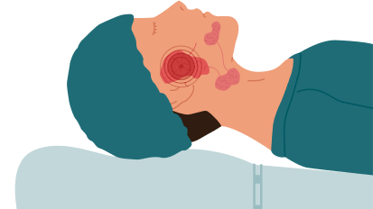 Salivary Tales: A Case-Based Overview of Salivary Gland Surgery
