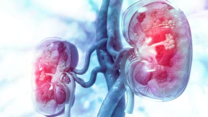 Complex Patient Case Review for Oncologic and Benign Urology