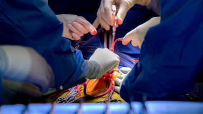2023 Cardiovascular Surgery Annual Report