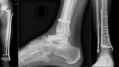 2025 Annual Orthopaedic Trauma and Arthroplasty Symposium