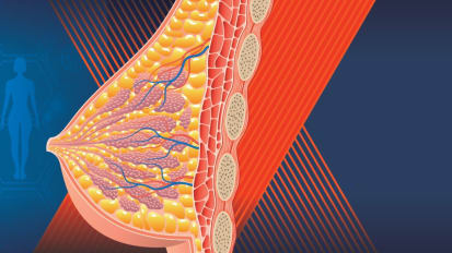 24th Annual Highlights of the 2025 San Antonio Breast Cancer Symposium