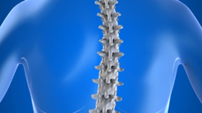 Best Practices for Fusion in Scoliosis Treatment 
