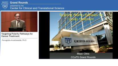 Grand Rounds: Targeting Polarity Pathways for Cancer Treatment