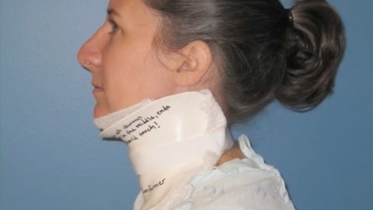 Burns 405: Neck Splint