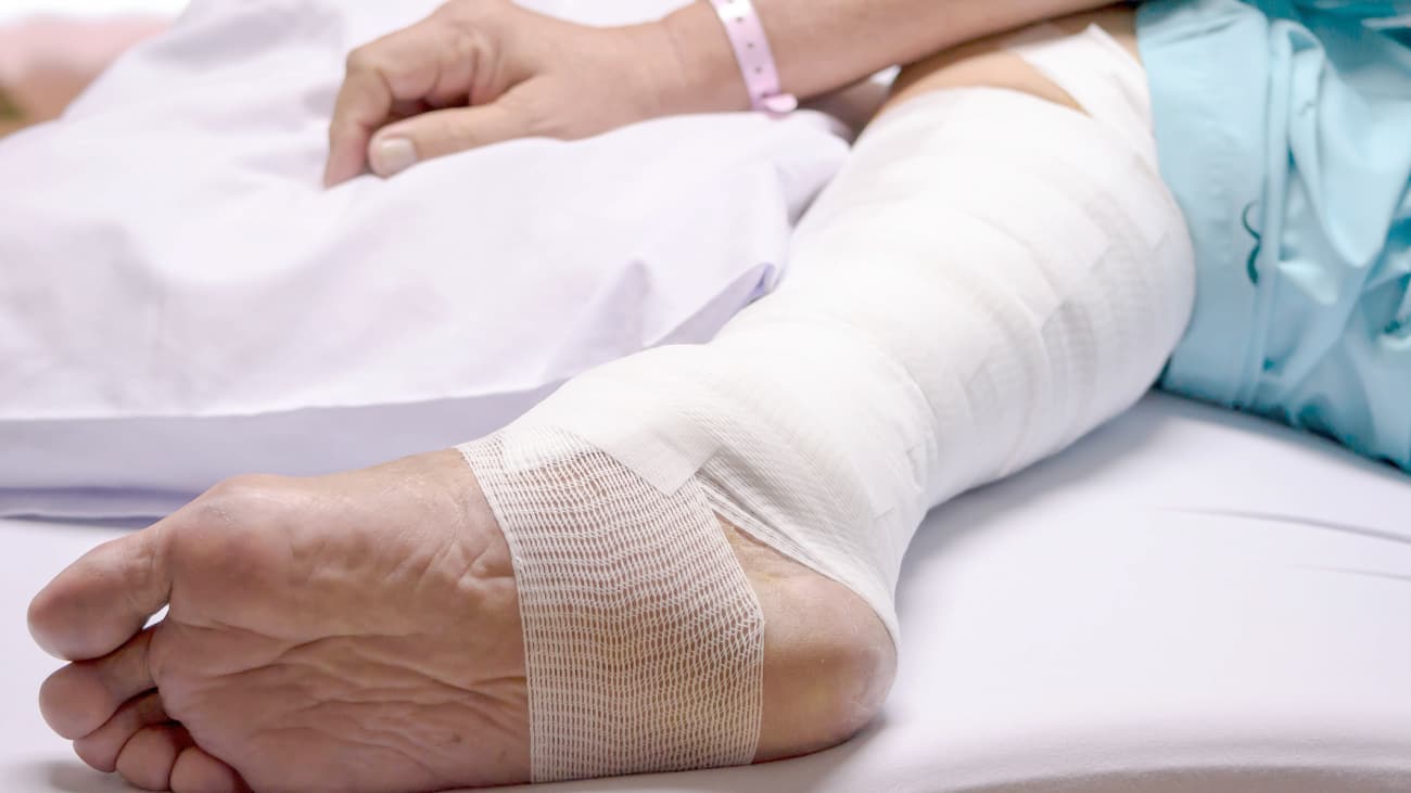 Venous Leg Ulceration: Approach to Management