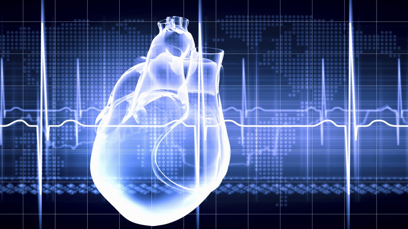 Atrial Fibrillation: State of the Art 