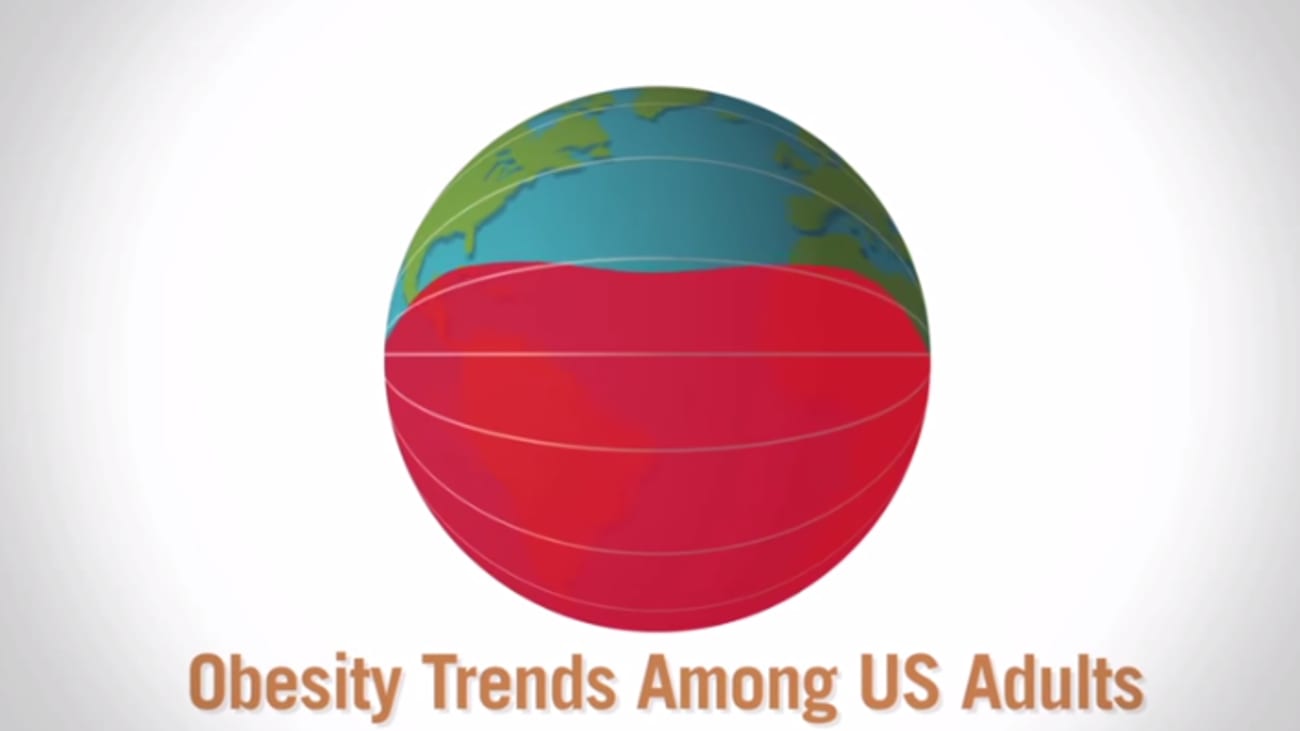 Over the Years: Obesity in the United States