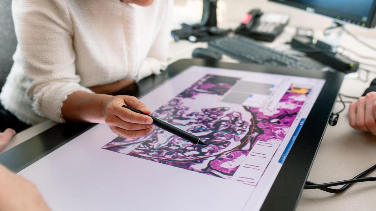 Mayo Clinic Talks Selection criteria for kidney transplantation Mayo