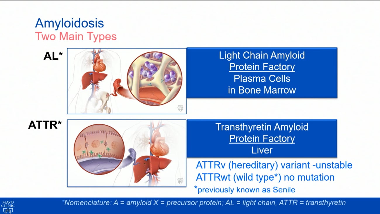 Transthyretin amyloid and new treatment options BroadcastMed