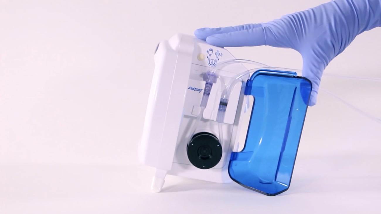 Setting Up and Operating the Kangaroo™ ePump for Feeding Only