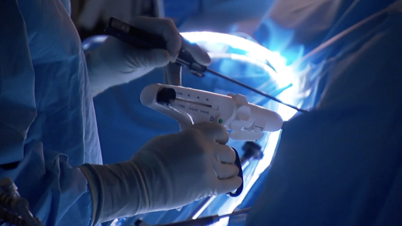 Bariatric surgery Mayo Clinic