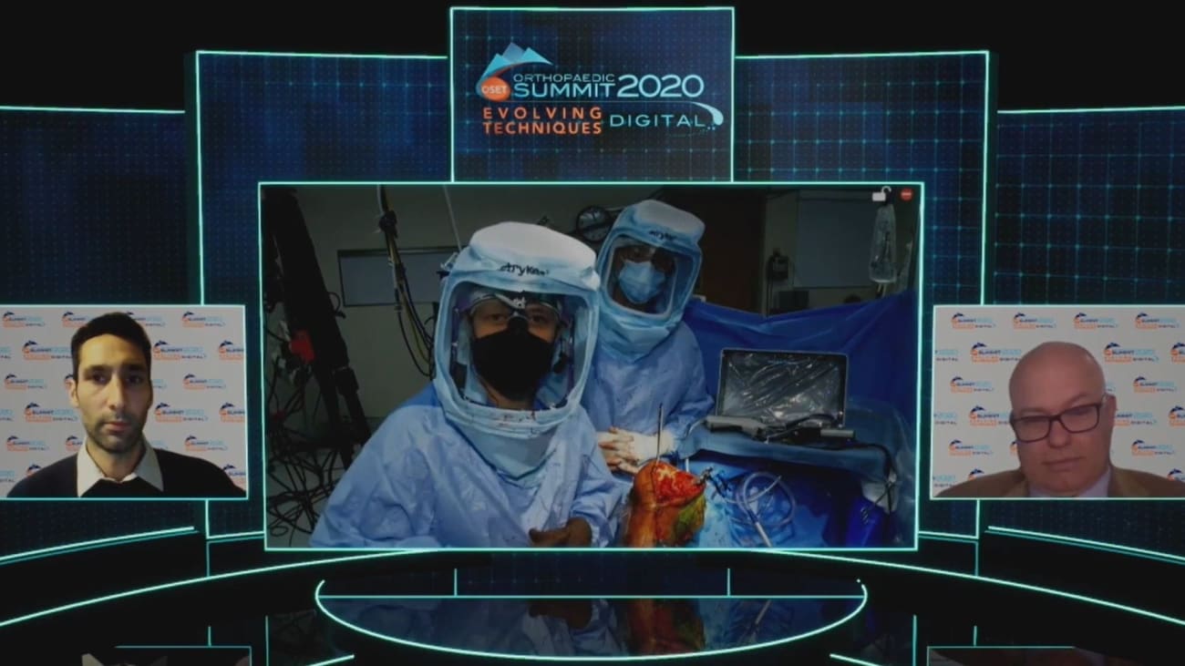 Live Surgery Bicruciate Ligament Sparing TKA with JOURNEY™ II XR