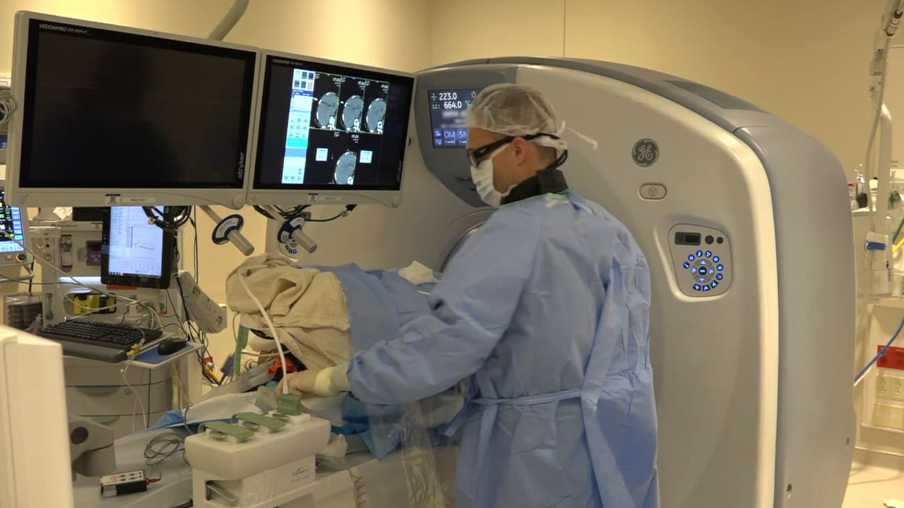 Microwave Ablation Therapy for Hepatocellular Carcinoma BroadcastMed