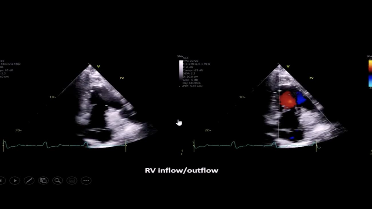 Houston Congenital Heart Disease Congenital Navigating Long-Term Care in Houston