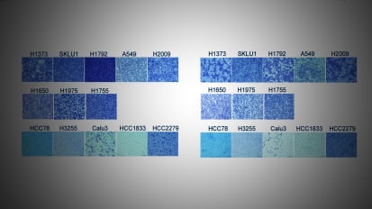 Gene Signatures May Predict Outcomes Among Similar-Appearing Tumors